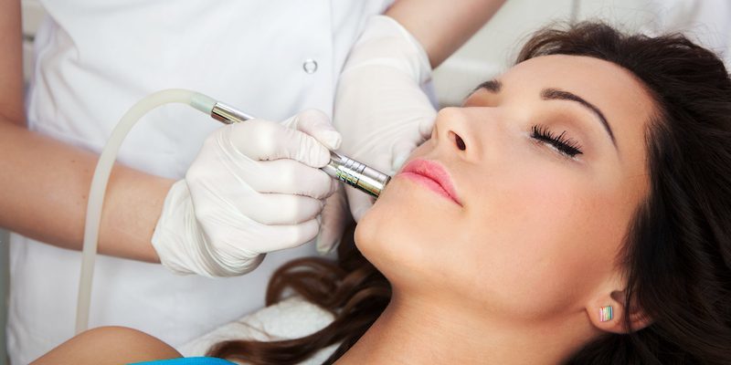 microdermabrasion